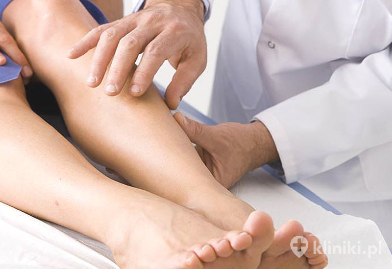 Usuwanie pajączków metodą skleroterapii Usuwanie pajączków metodą skleroterapii