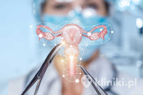 Histerektomia Histerektomia