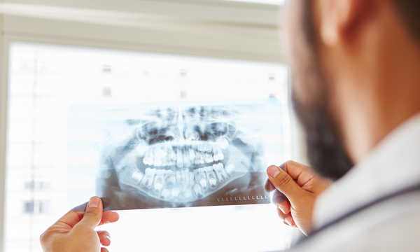 Lekarz trzymający zdjęcie rentgenowskie szczęki i wykonujący diagnostykę chirurgii jamy ustnej Lekarz trzymający zdjęcie rentgenowskie szczęki i wykonujący diagnostykę chirurgii jamy ustnej