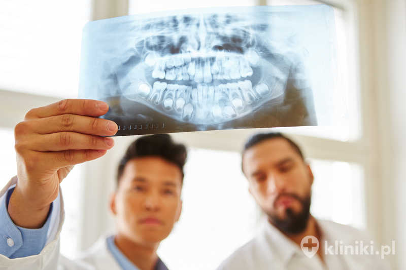 Lekarze oglądają zdjęcie rentgenowskie i analizują diagnozę chirurgii jamy ustnej Lekarze oglądają zdjęcie rentgenowskie i analizują diagnozę chirurgii jamy ustnej