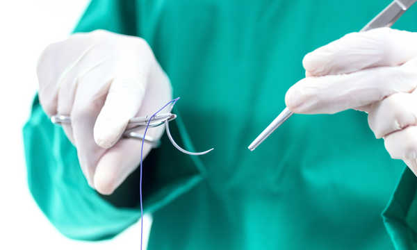 Drobne zabiegi chirurgiczne obejmują niewielkie procedury wykonywane w warunkach ambulatoryjnych Drobne zabiegi chirurgiczne obejmują niewielkie procedury wykonywane w warunkach ambulatoryjnych