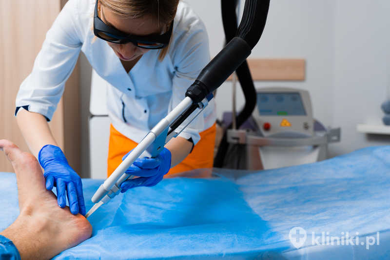 Usuwanie kurzajek laserem pozwala na ograniczenie ryzyka nawrotu i rozprzestrzeniania się zmian Usuwanie kurzajek laserem pozwala na ograniczenie ryzyka nawrotu i rozprzestrzeniania się zmian