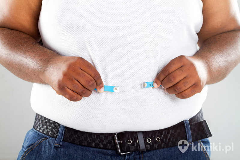 Zabieg endoskopowego zmniejszenia żołądka metodą Overstitch sprzyja redukcji masy ciała oraz poprawie chorób współistniejących z otyłością Zabieg endoskopowego zmniejszenia żołądka metodą Overstitch sprzyja redukcji masy ciała oraz poprawie chorób współistniejących z otyłością