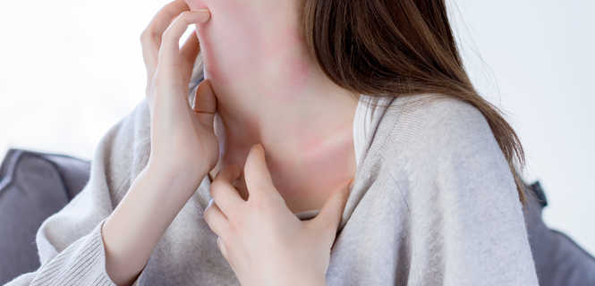 Atopowe zapalenie skóry – przyczyny, objawy i leczenie